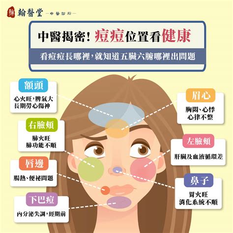 眉心長痘痘運勢|誰的眉心長痘最旺運？